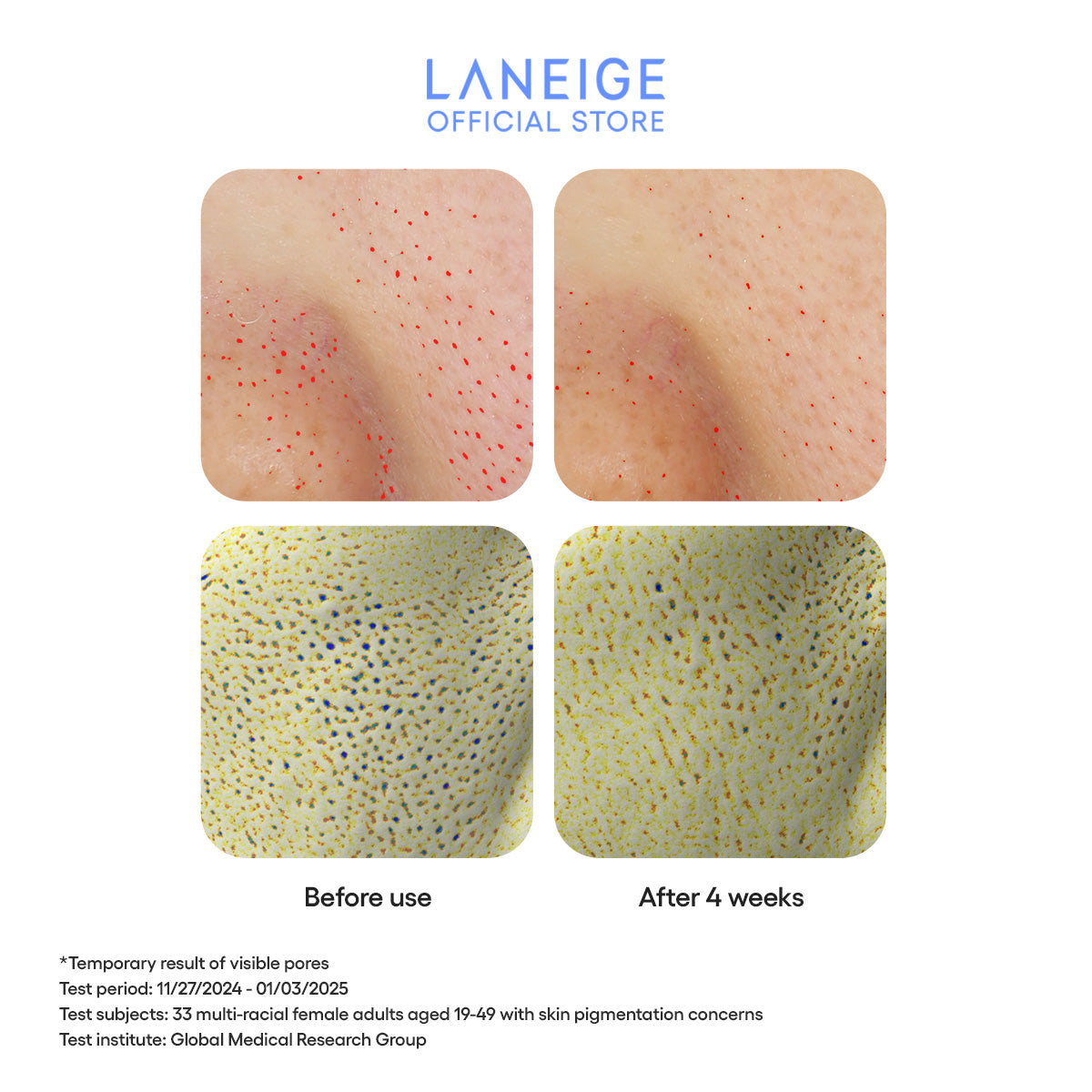 A before-and-after image shows a visible reduction in pore size after four weeks of using Laneige's Cream Skin Zincpeptide 2-in-1 Toner & Gel Moisturizer, as demonstrated by a clinical study.