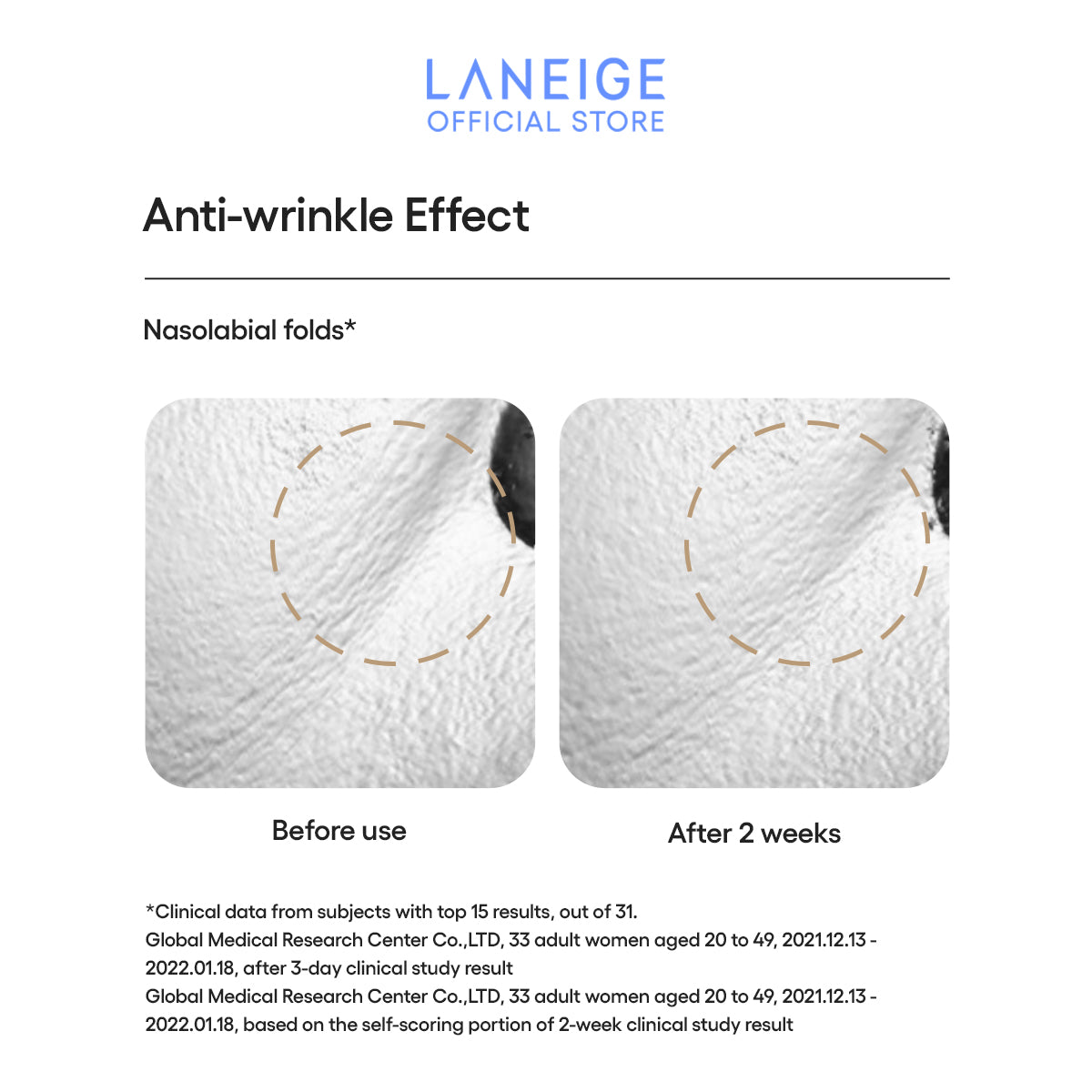 Before and after close-ups of nasolabial folds showing reduced wrinkles after two weeks of Laneige sun essence use.